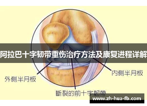 阿拉巴十字韧带重伤治疗方法及康复进程详解